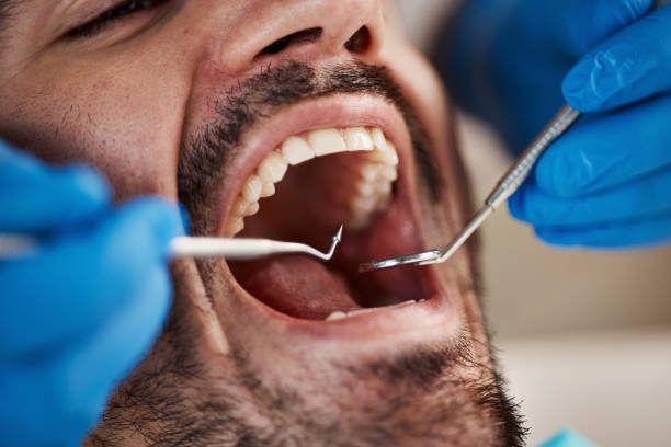 Best Emergency Dental Extractions in Magna, UT